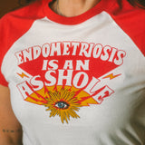 T-Shirt „Endometriosis is an Asshole"